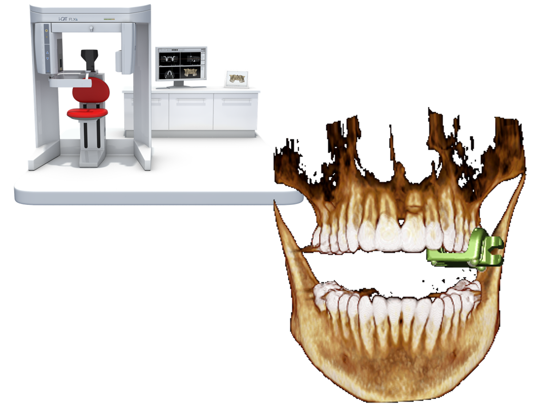 西鉄久留米駅から徒歩5分の歯医者・矯正歯科・インプラント「菊池歯科矯正歯科医院」|pbmの充電をします